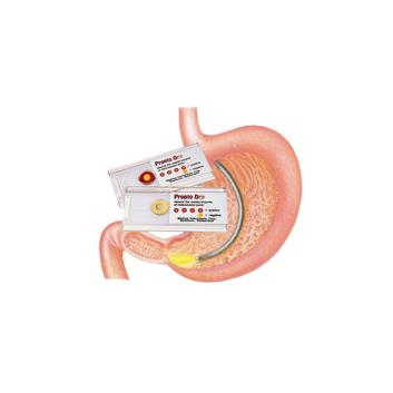 Helicobacter Pylori Schnelltest 